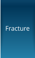 Fracture